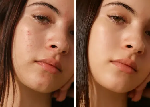 Before and after an AI glow up